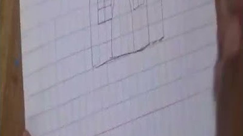 树脂补牙一颗几百到上千，差距到底在哪